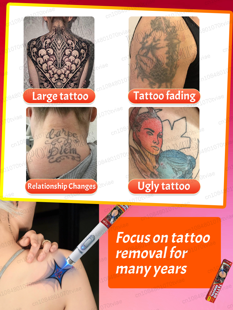 Nano laser tattooʀᴇᴍᴏᴠᴀʟ ᴘᴇɴ:  - Laser Toner Powder avis et prix